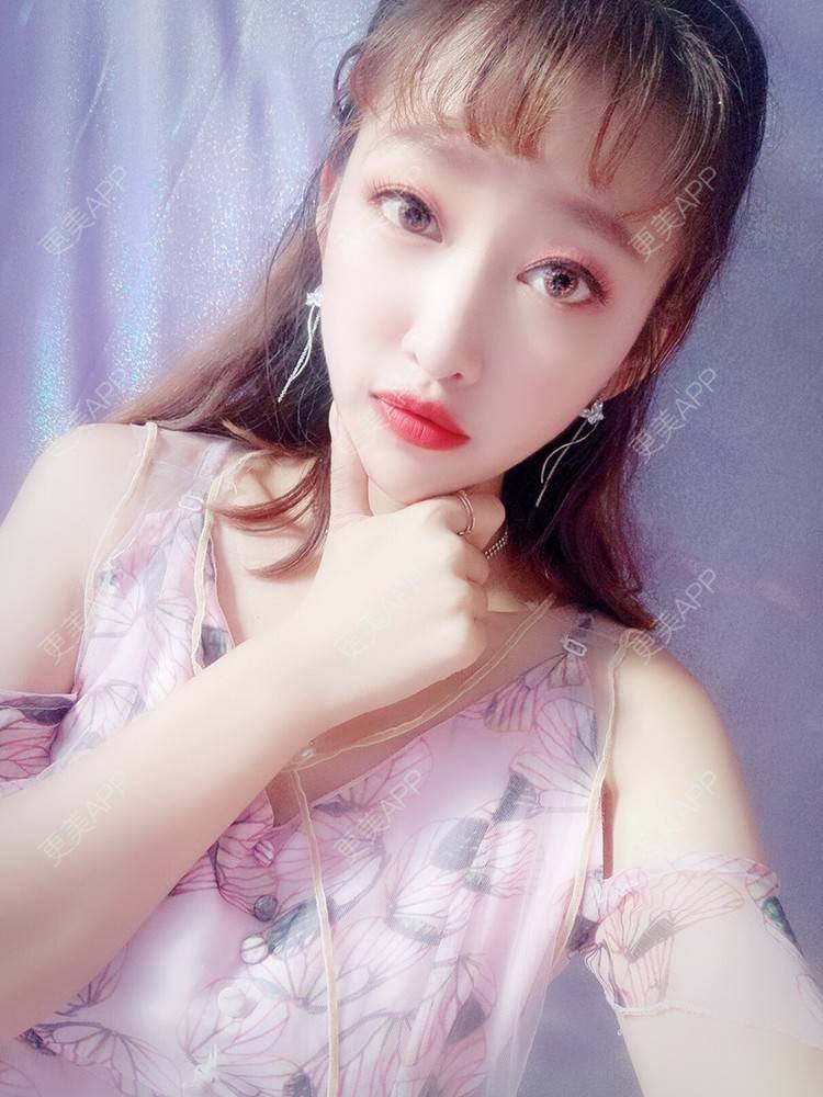 更美 - 更美用户54uEUJyRUs的隆鼻经验 | 隆鼻 | 硅胶隆鼻 | 耳软骨隆鼻 | 歪鼻矫正 | 鼻翼缩小 | 温州