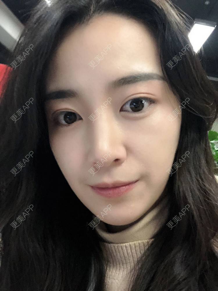 更美 - 范萌知 医生的隆鼻经验 | 隆鼻 | 嘉兴