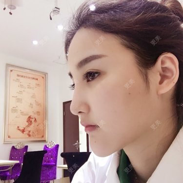 赵艳 医生
