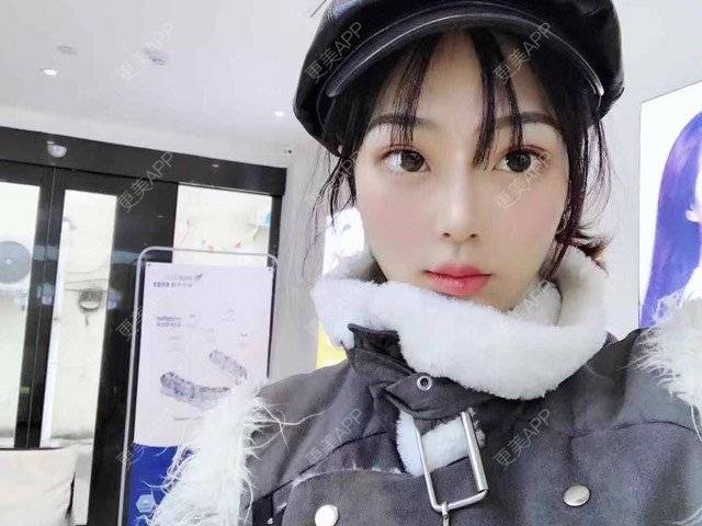 更美 - 更美用户SJNn84fVNk的经验 | 宁波
