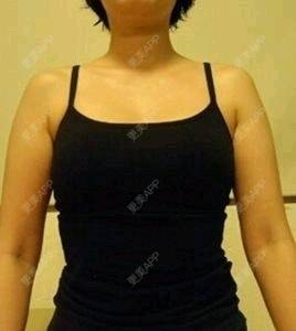 更美 - 小仙女～～～的吸脂经验 | 丰胸（隆胸） | 武汉 | 超声波洗牙 | 上海 | 吸脂瘦脸 | 隐形牙齿矫正 | 隆鼻 | 鼻部多项 | 毛发移植 | 南昌 | 深圳 | 吸脂 | 南京 | 玻尿酸 | 成都 | 福州 | 自体脂肪隆胸 | 大连 | 下巴 | 热拉提 | 黑脸娃娃 | 除皱瘦脸 | 热玛吉 | 女性私密