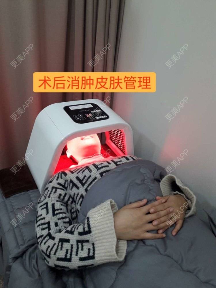 更美 - 更美用户VHj5R052qm的轮廓套餐经验 | 面部不对称矫正 | 轮廓套餐