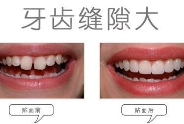 八卦来了