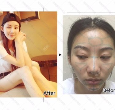 皮肤综合管理套餐