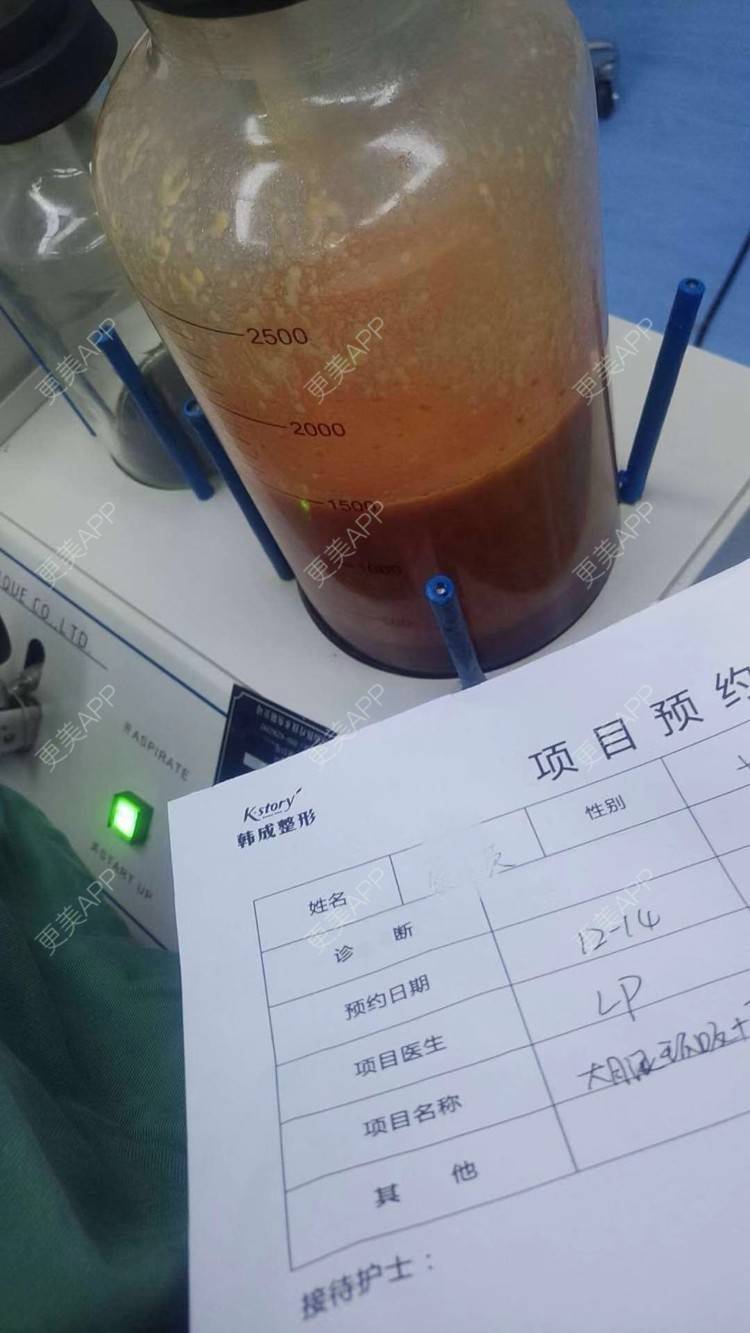 更美 - 玫瑰園的百合🌼的吸脂瘦大腿经验 | 吸脂塑臀 | 吸脂瘦大腿