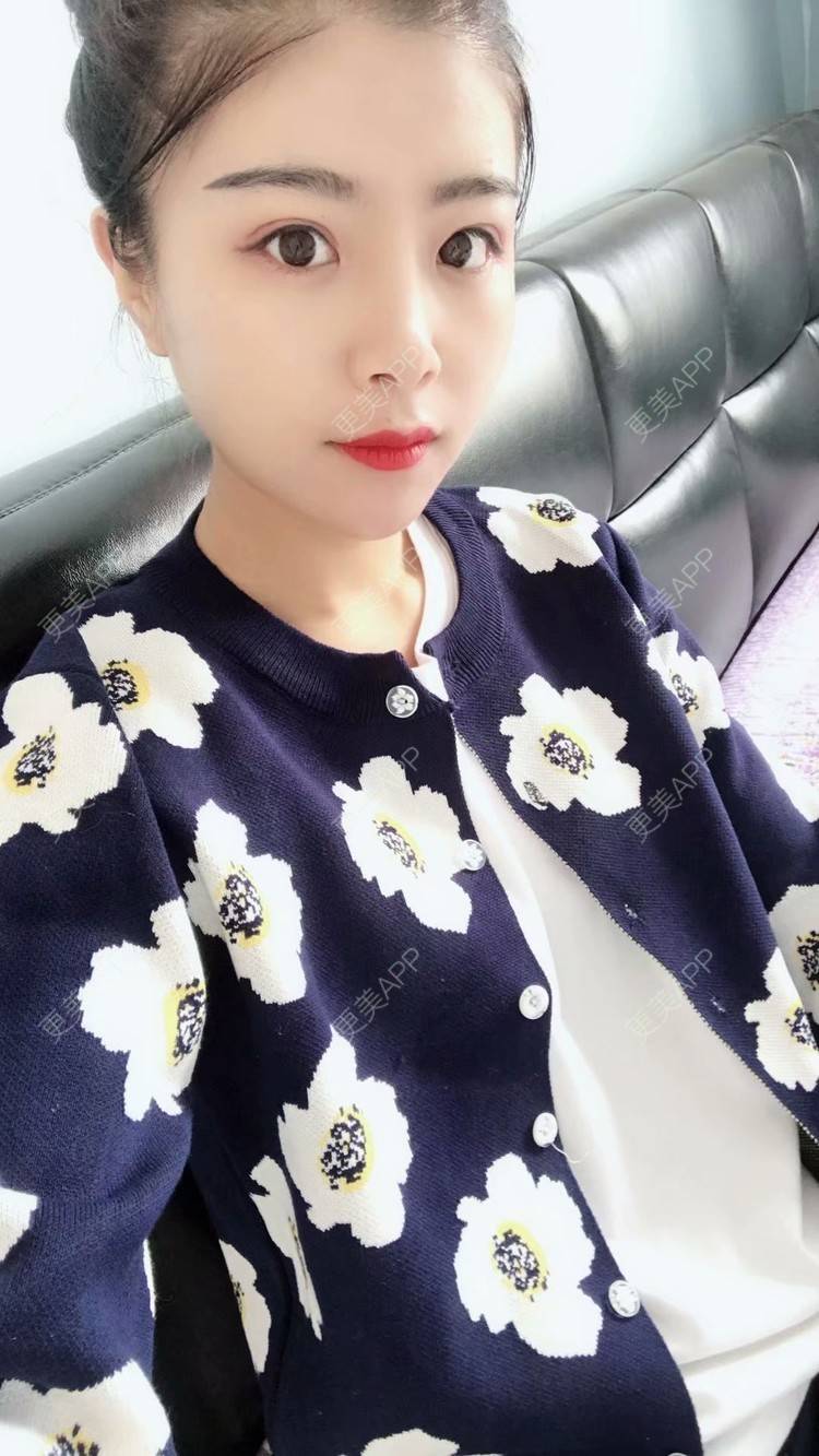 更美 - 覃新月 医生的水光项目经验 | 水光项目 | 南宁