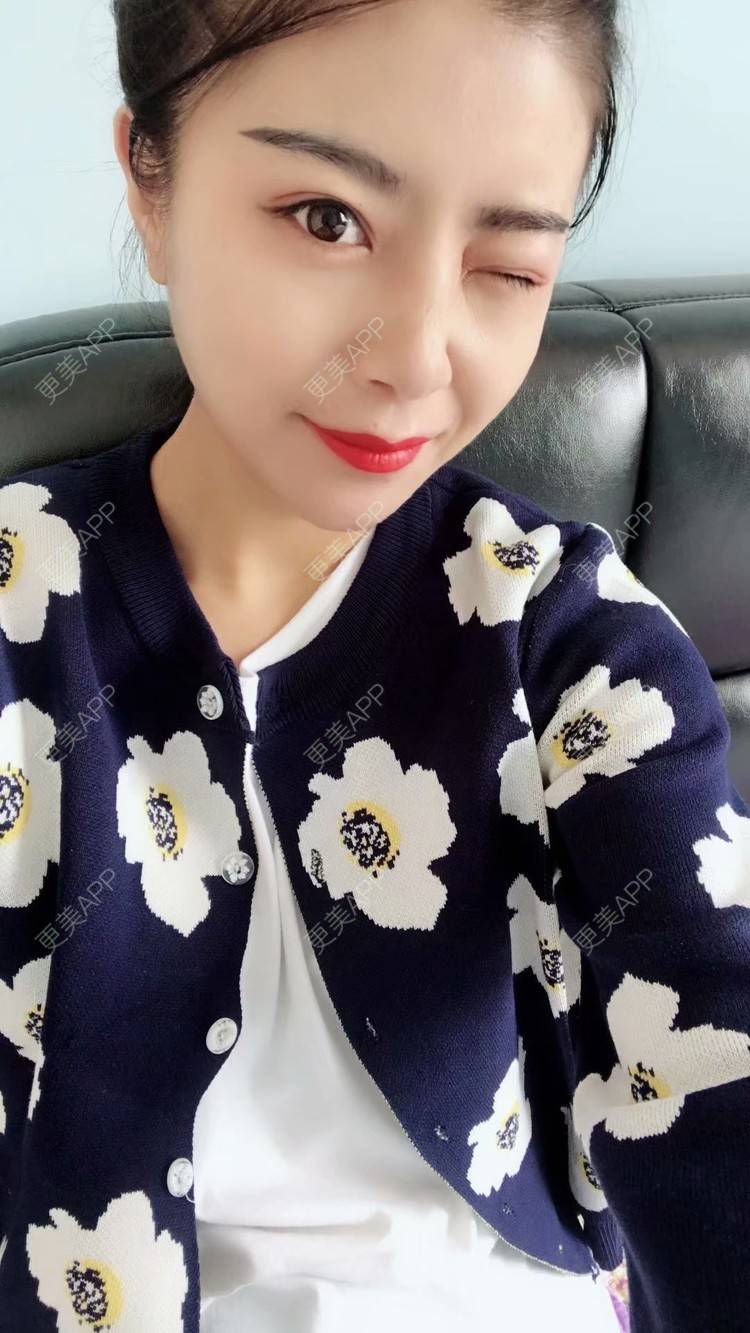 更美 - 覃新月 医生的水光项目经验 | 水光项目 | 南宁