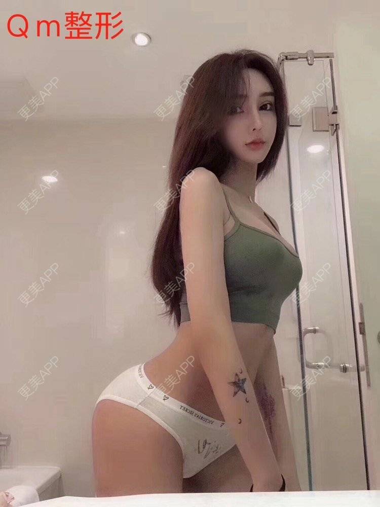 更美 - 祢的美丽/我的职责的自体脂肪丰臀经验 | 自体脂肪丰臀