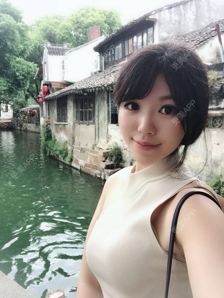更美 - 张书毓 医生的自体脂肪全面部填充经验 | 自体脂肪全面部填充 | 沈阳 | 视频日记