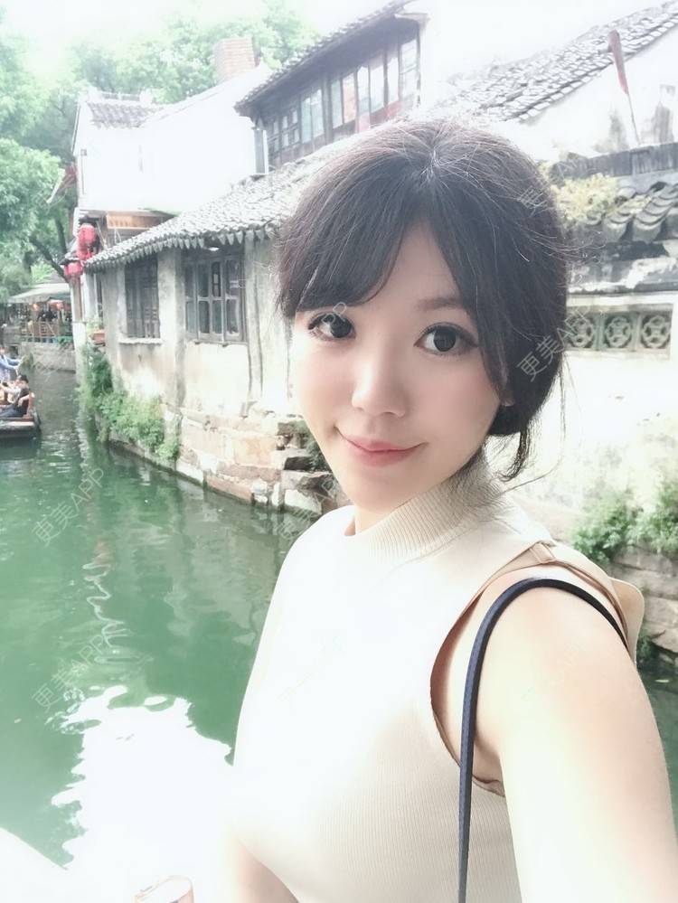 更美 - 张书毓 医生的自体脂肪全面部填充经验 | 自体脂肪全面部填充 | 沈阳 | 视频日记