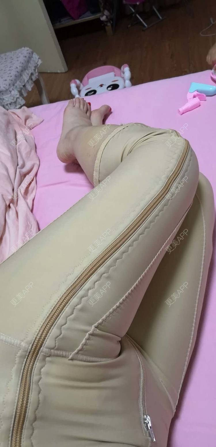 rin1的吸脂瘦大腿日记