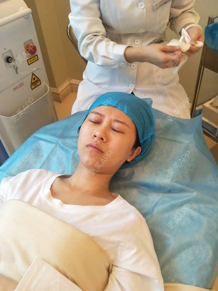 更美 - 更美用户qFi8xuX6UQ的激光去脂肪粒经验 | 激光去脂肪粒