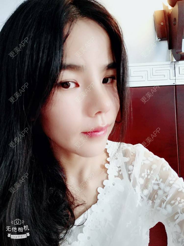 更美 - 张翎 医生的硅胶隆鼻经验 | 硅胶隆鼻 | 南宁