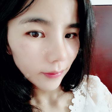 张翎 医生