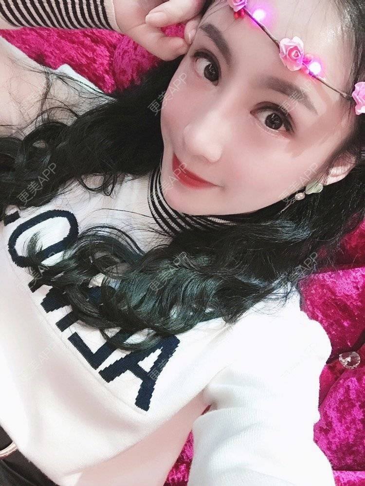 更美 - 卡门小妖精，的玻尿酸卧蚕经验 | 玻尿酸卧蚕 | 重庆 | 自体脂肪丰卧蚕 | 真皮丰卧蚕 | 双眼皮修复 | 眼部多项