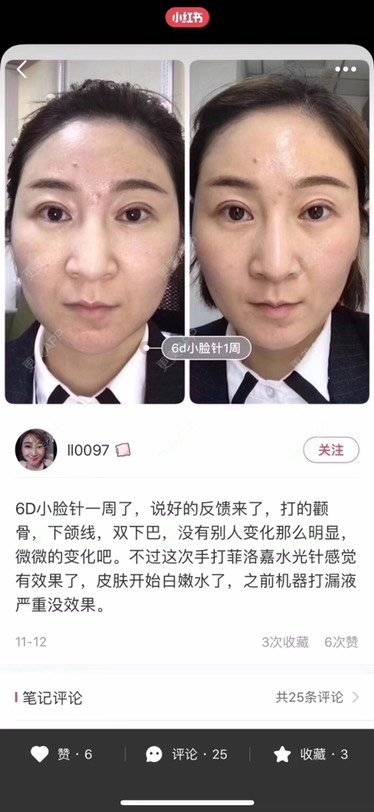 更美 - OT-老康的改善肤质经验 | 改善肤质 | 颈部 | 广州