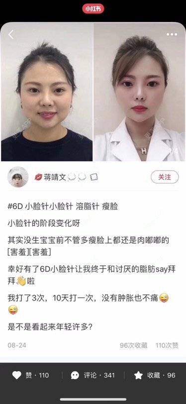 更美 - OT-老康的改善肤质经验 | 改善肤质 | 颈部 | 广州