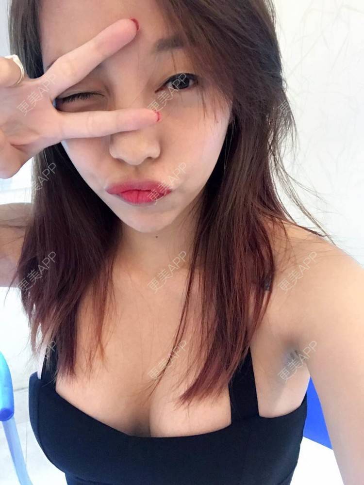 更美 - 邓晧畇 医生的假体隆胸经验 | 假体隆胸 | 南宁