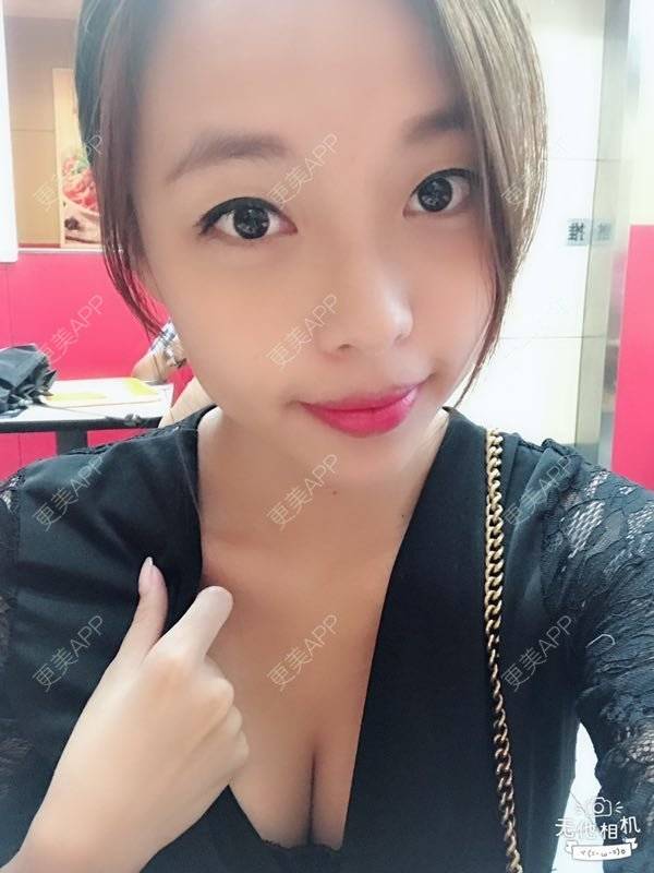 更美 - 邓晧畇 医生的假体隆胸经验 | 假体隆胸 | 南宁