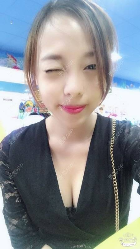 更美 - 邓晧畇 医生的假体隆胸经验 | 假体隆胸 | 南宁