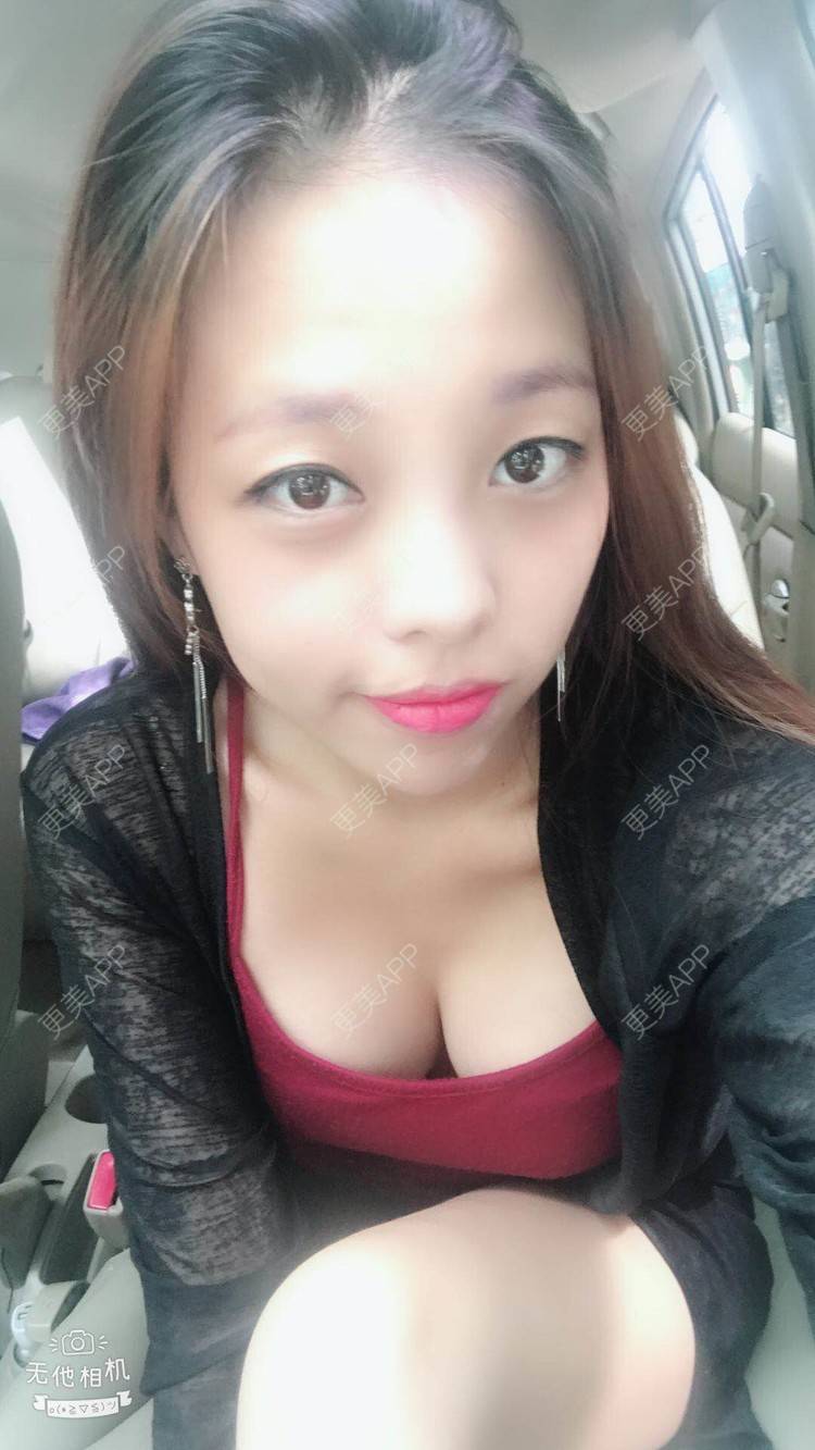 更美 - 邓晧畇 医生的假体隆胸经验 | 假体隆胸 | 南宁