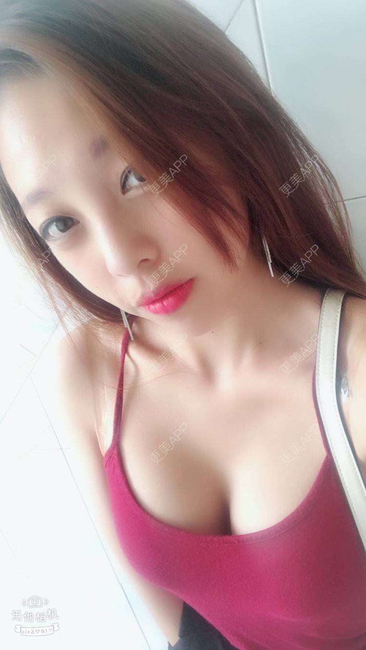 更美 - 邓晧畇 医生的假体隆胸经验 | 假体隆胸 | 南宁