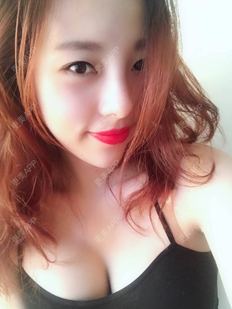 更美 - 邓晧畇 医生的假体隆胸经验 | 假体隆胸 | 南宁