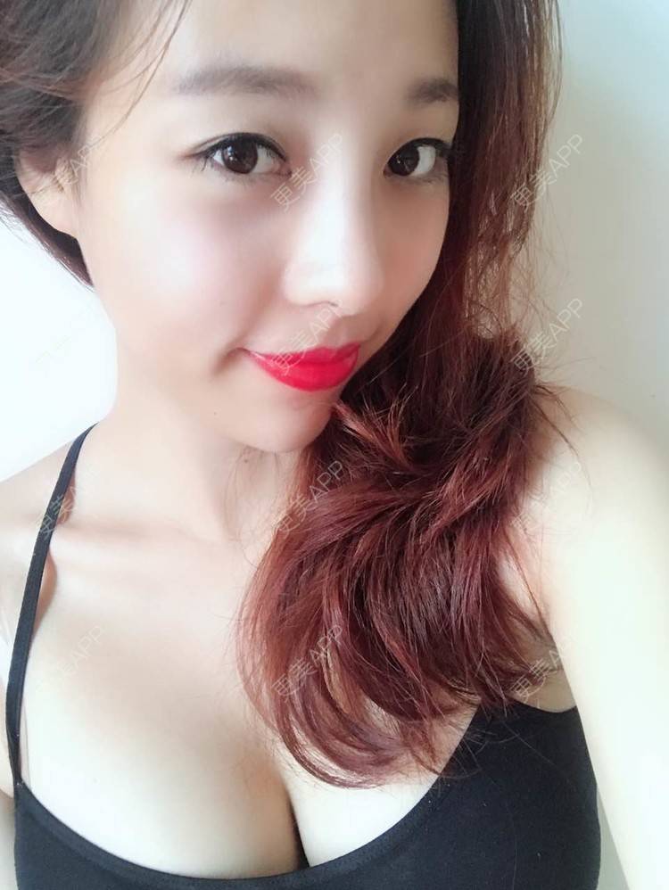 更美 - 邓晧畇 医生的假体隆胸经验 | 假体隆胸 | 南宁