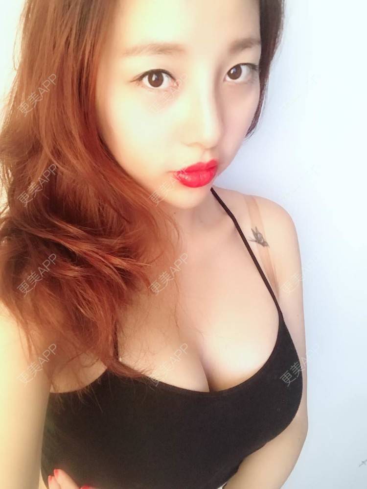 更美 - 邓晧畇 医生的假体隆胸经验 | 假体隆胸 | 南宁