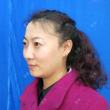 房红超 医生