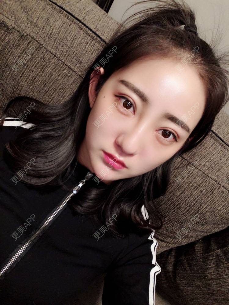 更美用户guzrsegz7l的眼综合日记