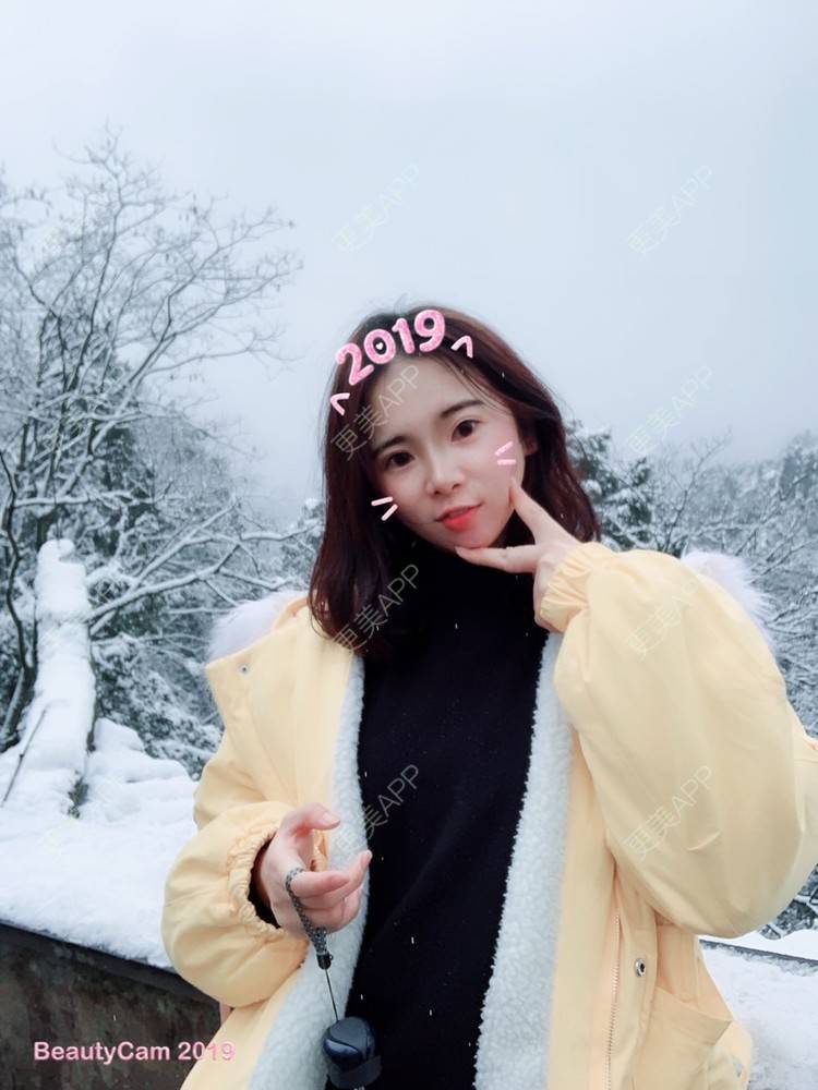 更美 - 九 五.的全切双眼皮经验 | 全切双眼皮 | 内切去眼袋 | 自体脂肪填充泪沟 | 更美研究所 | 视频日记