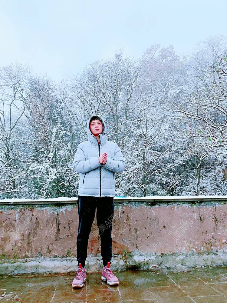 更美 - 九 五.的全切双眼皮经验 | 更美研究所 | 注射美白 | 水光项目 | 全切双眼皮 | 内切去眼袋 | 自体脂肪填充泪沟 | 视频日记