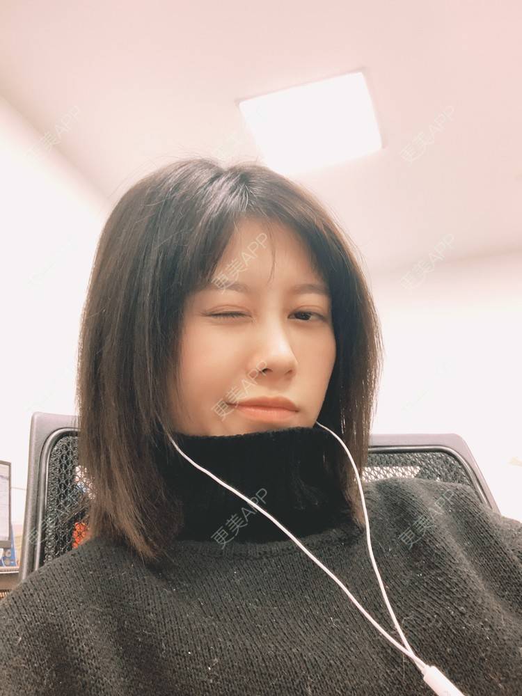 更美 - 更美用户qFi8xuX6UQ的激光去脂肪粒经验 | 激光去脂肪粒