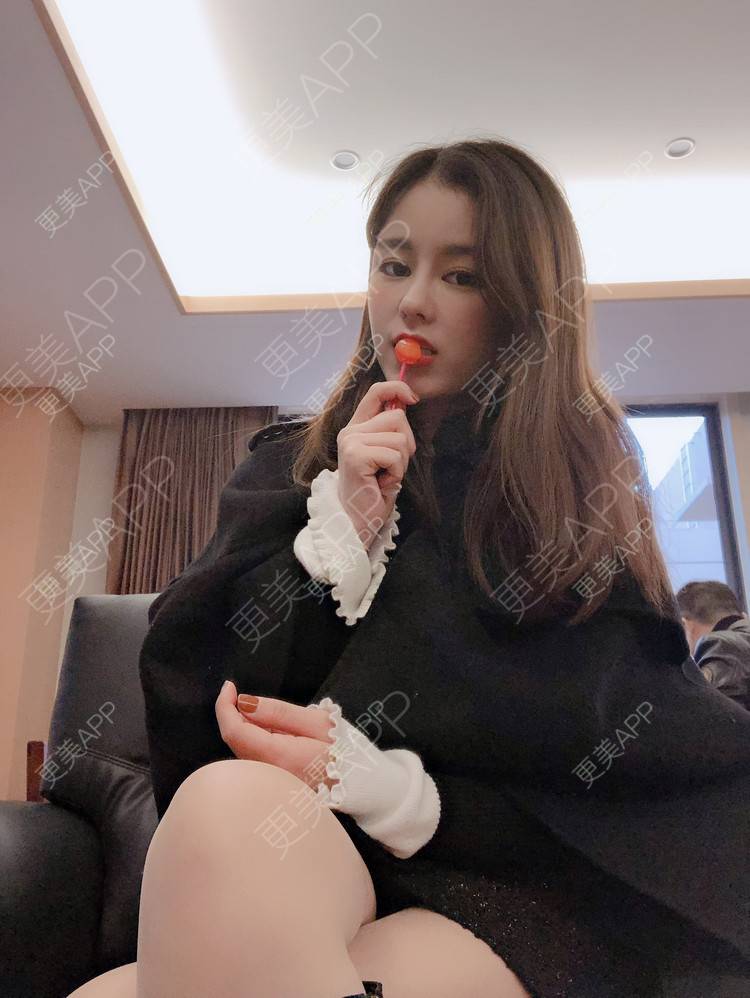更美 - 更美用户5xHgNpMoLr的鼻部膨体假体取出经验 | 杭州 | 鼻部膨体假体取出 | 视频日记