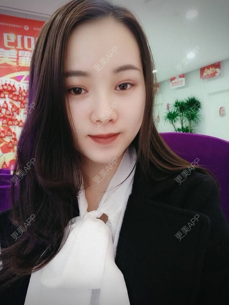 更美 - 米连菊 医生的玻尿酸鼻部经验 | 广州 | 玻尿酸鼻部