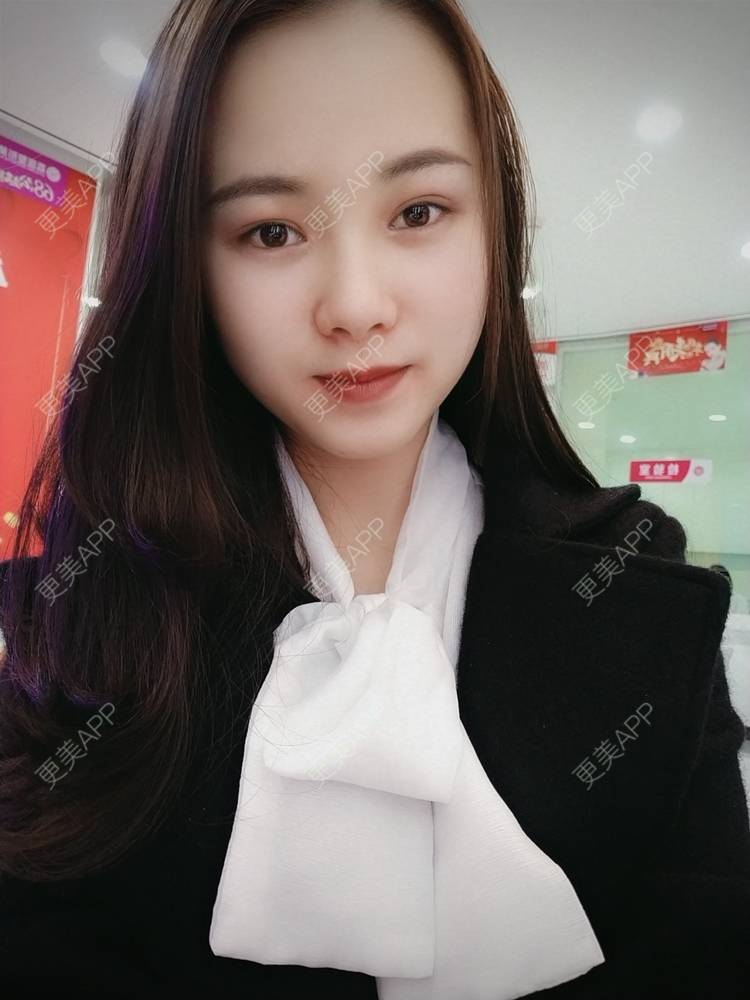 更美 - 米连菊 医生的玻尿酸鼻部经验 | 广州 | 玻尿酸鼻部