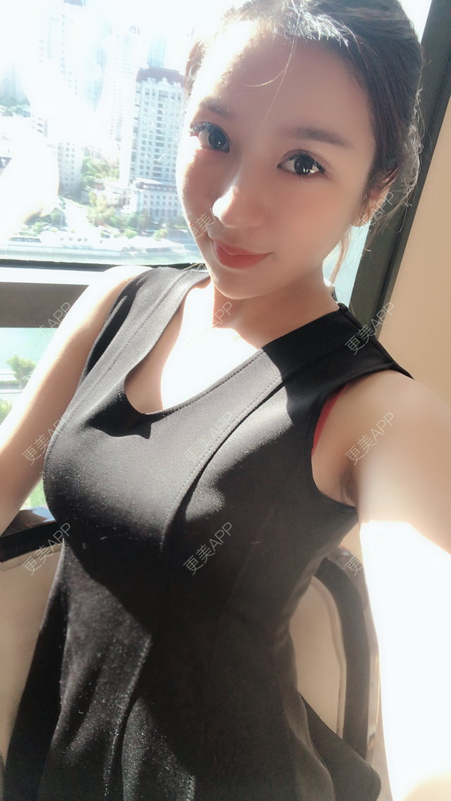 假体隆胸 | 自体脂肪隆胸 | 玻尿酸隆胸 | 胶原蛋白丰胸 | 丰胸