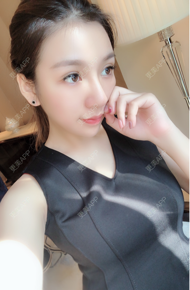 假体隆胸 | 自体脂肪隆胸 | 玻尿酸隆胸 | 胶原蛋白丰胸 | 丰胸