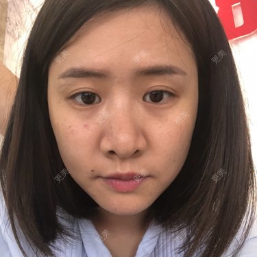 欧巴桑💋🙈🤒🤒