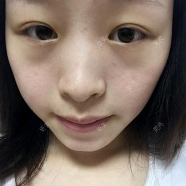 高步宽 医生
