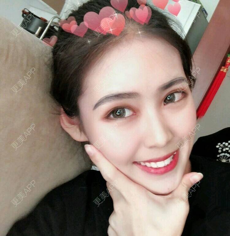 更美 - 街头溜达的拔龋齿经验 | 拔龋齿 | 成都