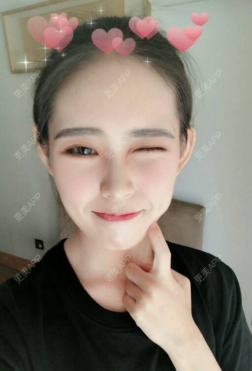 更美 - 街头溜达的拔龋齿经验 | 拔龋齿 | 成都