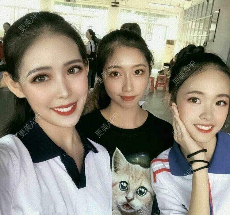更美 - 街头溜达的拔龋齿经验 | 拔龋齿 | 成都
