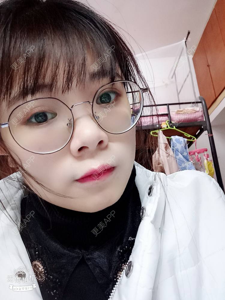 更美 - 更美用户2xAqCgwVY0的内切去眼袋经验 | 内切去眼袋 | 武汉