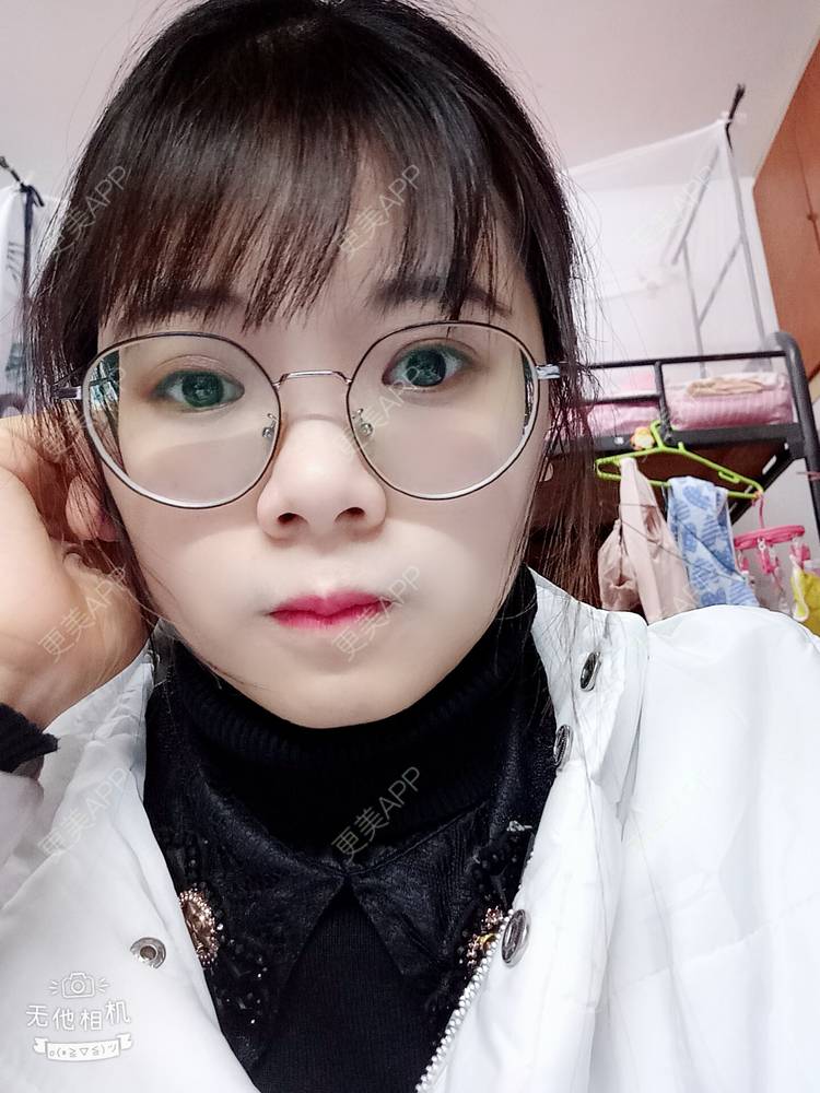 更美 - 更美用户2xAqCgwVY0的内切去眼袋经验 | 内切去眼袋 | 武汉