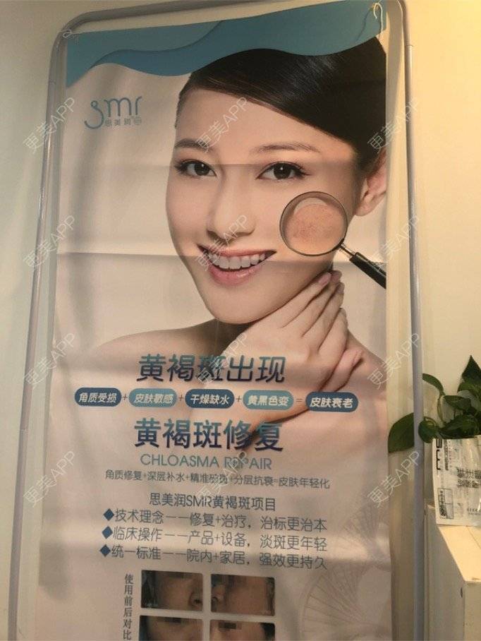 更美 - 更美用户KWUMYf8aC4的白瓷娃娃经验 | 成都 | 祛斑祛色素 | 自体脂肪隆胸 | 水光项目 | 双眼皮 | 上海 | 瘦脸除皱 | 西安 | 假体隆胸 | 白瓷娃娃 | 无锡 | PRP自体血清美肤 | 广州 | 深圳 | 东莞