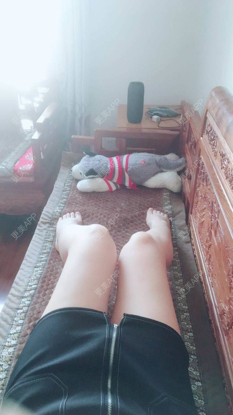 天上的月亮不说话的吸脂瘦大腿日记