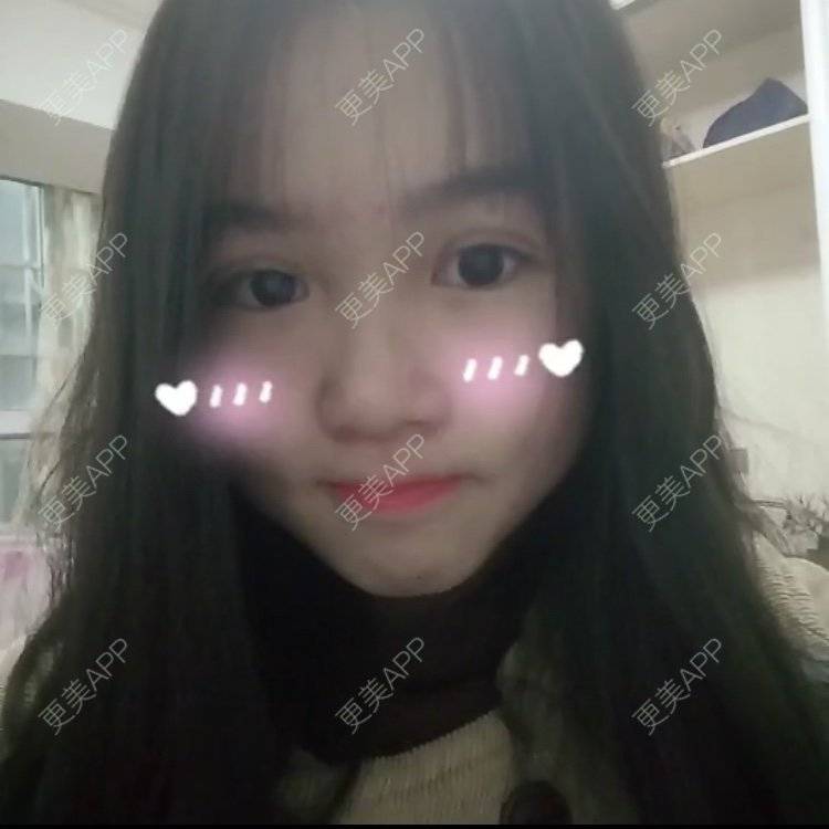 更美 - 更美用户wbJan4VHp8的眼皮下垂矫正经验 | 长沙 | 眼皮下垂矫正