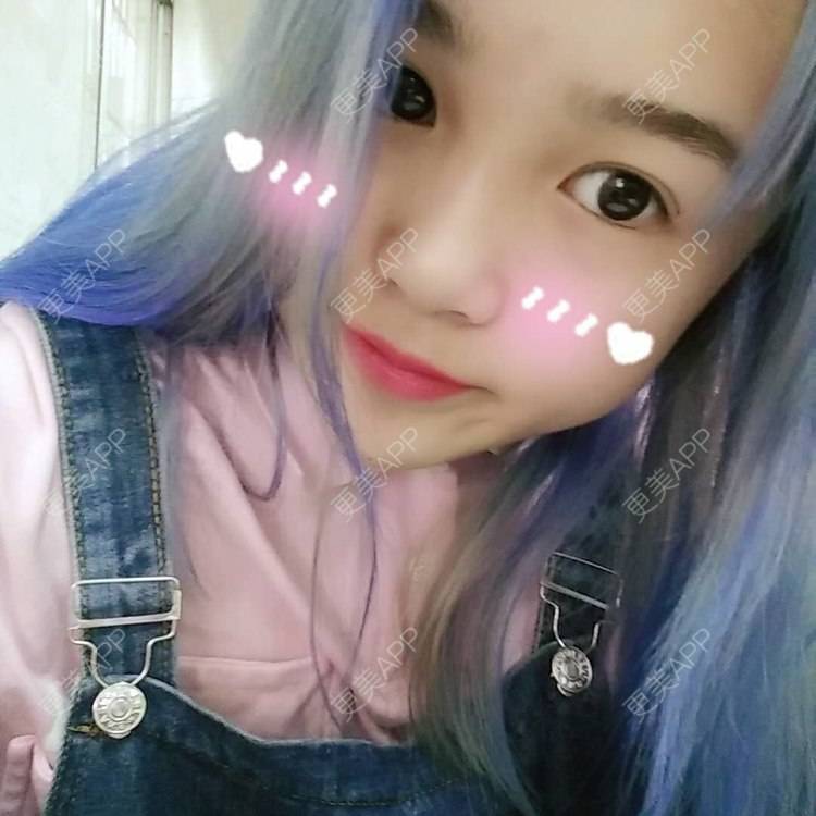 更美 - 更美用户wbJan4VHp8的眼皮下垂矫正经验 | 长沙 | 眼皮下垂矫正